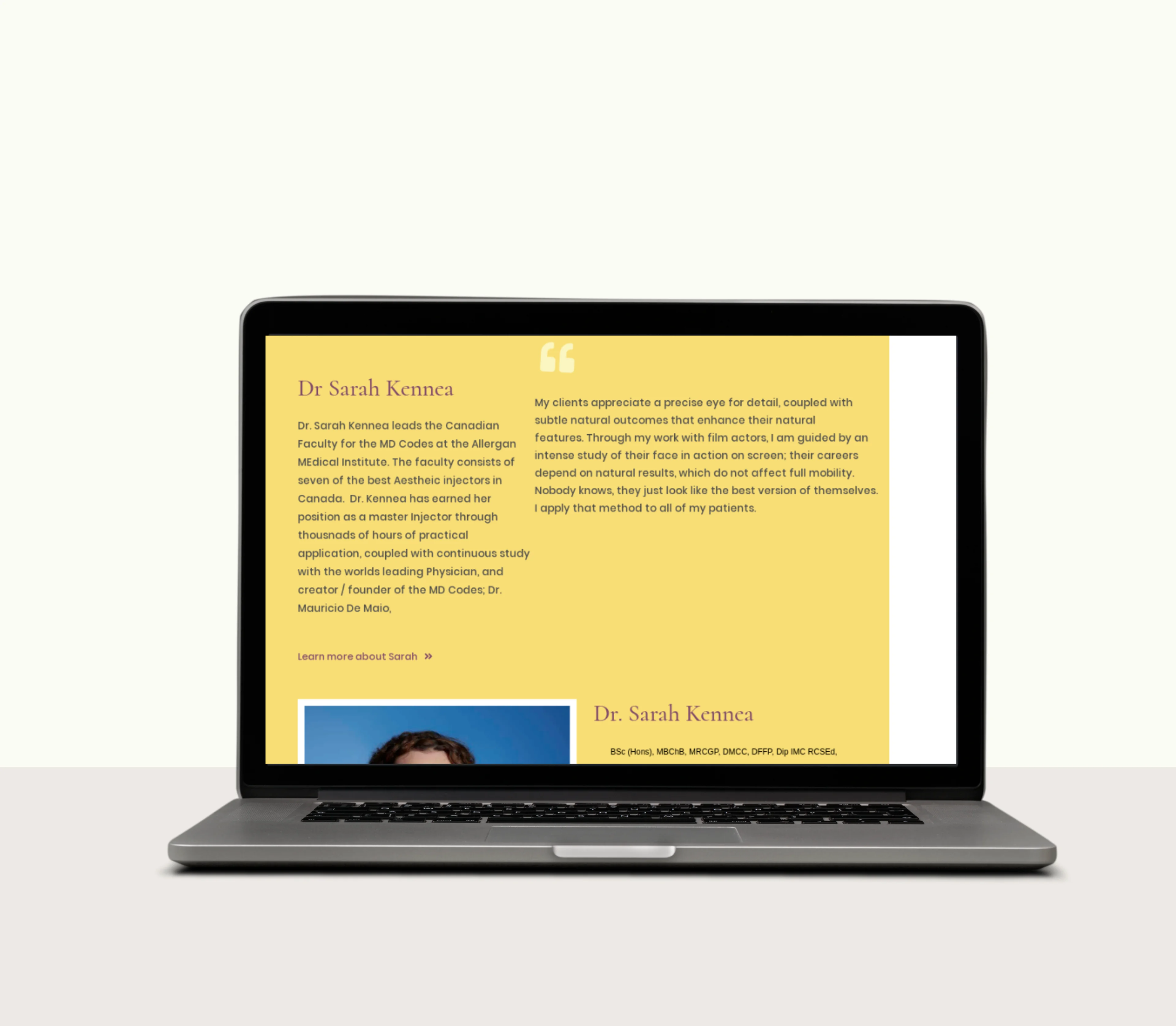 Project Preview